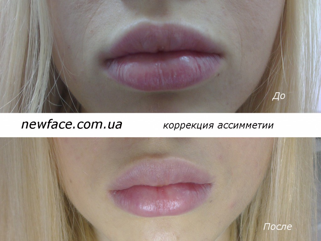 lips0834