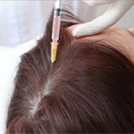 плазмолифтинг волос для женщин