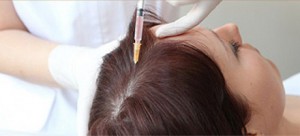 плазмолифтинг волос для женщин